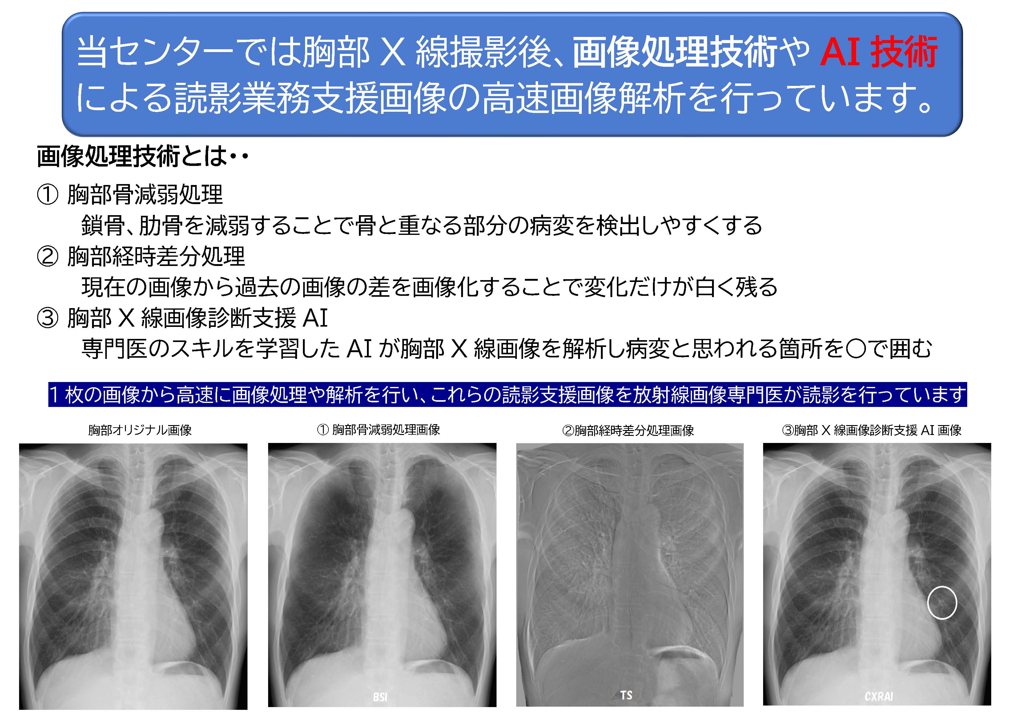 X線画像 